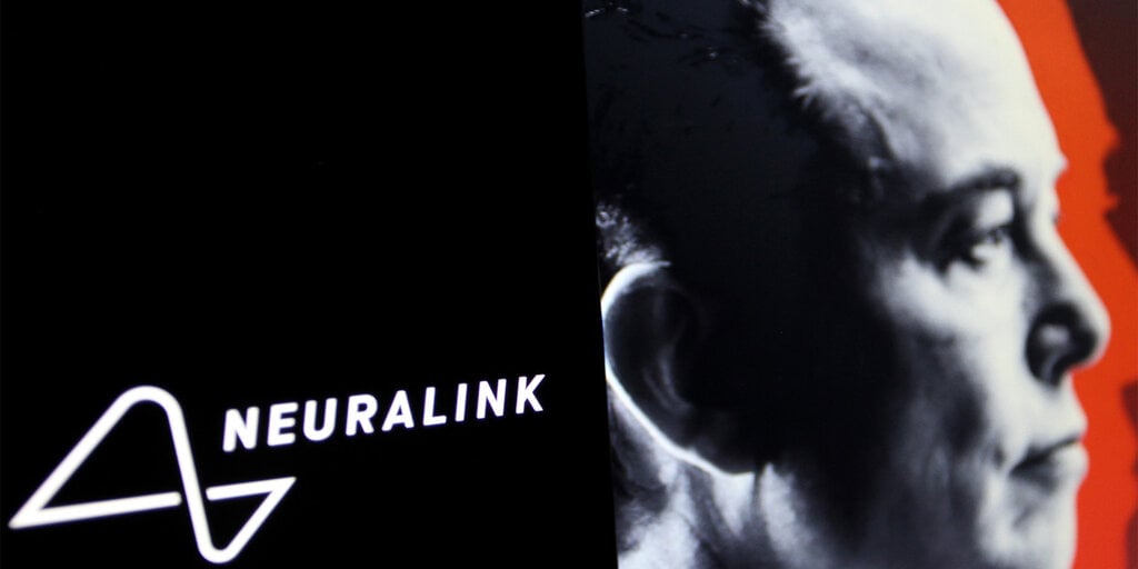 Elon Musk’s Neuralink Opens Its Doors for Brain Implant Human Trials
